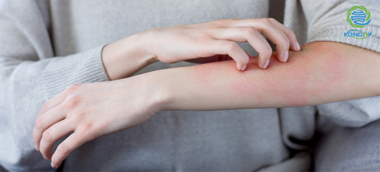 kongdymedical|What Should I Do If I Am Allergic To Pain Relief Patch?