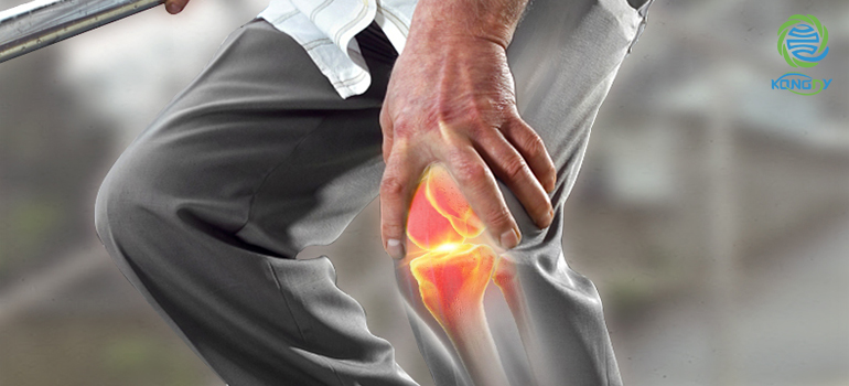 kongdymedical|How To Prevent Arthritis